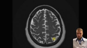 Как описывать рутинное МРТ головного мозга? #мрт #кт #головноймозг