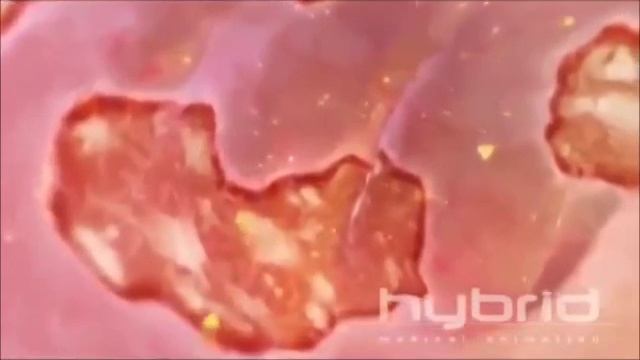 Болезнь крона - презентация про болезнь