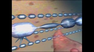 Лекарство от рассеянного склероза найдено!