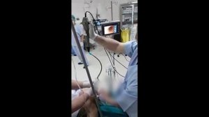 Практична употреба на флексибилен видео ларингоскоп