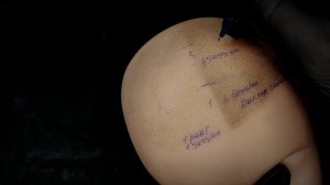 трихопигментация мини введение (г.Стерлитамак)