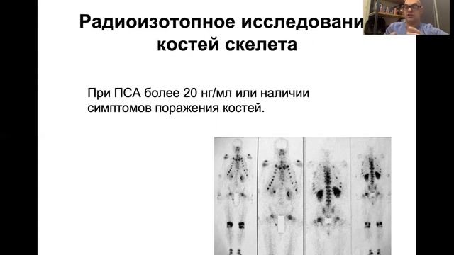 Пациентские лекции. Рак предстательной железы. Профессор Колонтарев К.Б.