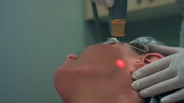 Laser Genesis Cutera XEO
