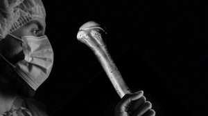 Плечевая кость