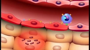 Влияние гипергликемии на иммунную систему