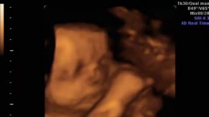 Xavier Isaiah Lee - Last 3D Ultrasound (31 Weeks)