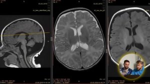 Ламповый разбор. Эпизод 3. Нейрорадиология.