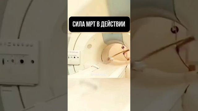 Сила МРТ в действии!