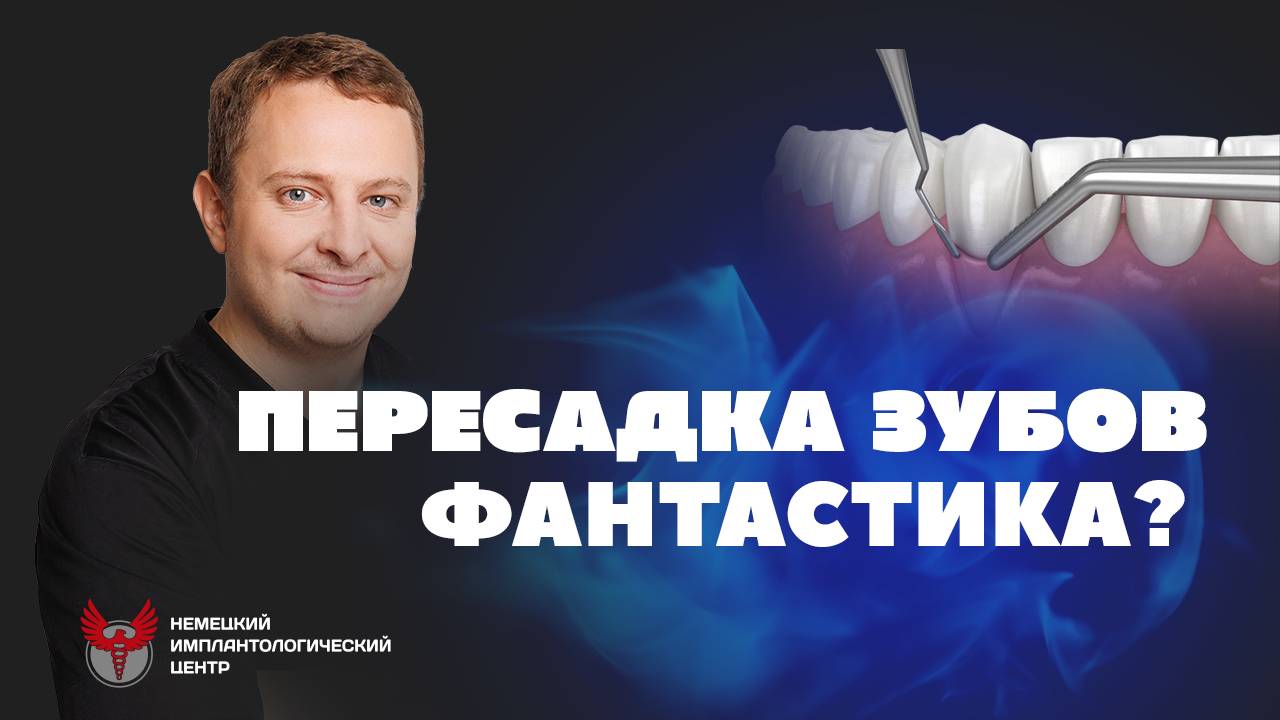 Аутотрансплантация: пересадка своих зубов. Как такое возможно? - Немецкий имплантологический центр