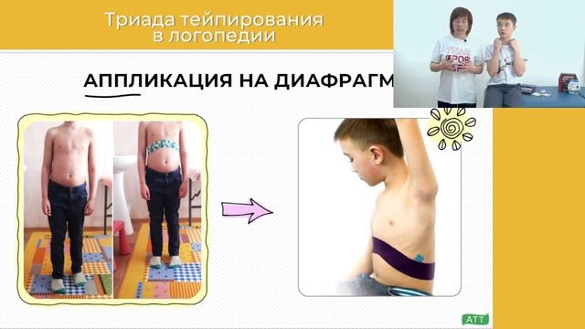 Как_включить тейпирование вработу_логопеда. Триада тейпирования.