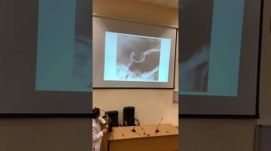 Гормонально-неактивные образования гипофиза. Селлярный синдром, синдром «пустого» турецкого седла