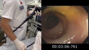 Колоноскопия под наркозом