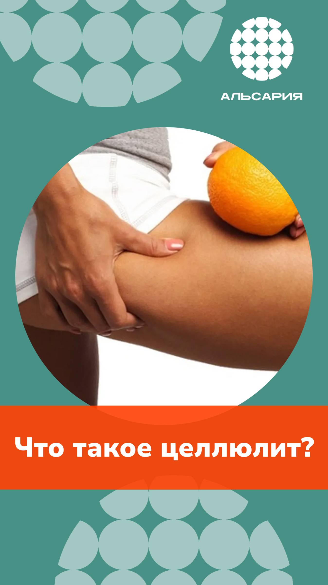 Что такое целлюлит?
