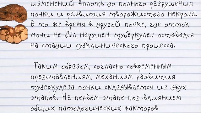 ТУБЕРКУЛЁЗ ПОЧКИ. Симптомы и Методы Лечения ПОЧЕК, Пораженных Туберкулёзом. Исследования СССР.