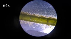 ТАКУЮ АКВАРИУМИСТИКУ НЕ ПОКАЖУТ! ИНФУЗОРИЯ СУВОЙКА. Vorticella