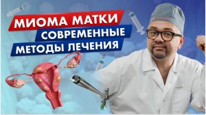 Миома матки: современные методы лечения