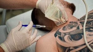 СДАВЛЕНИЕ НЕРВА В ШЕЕ || Синдром грудного выхода TOS