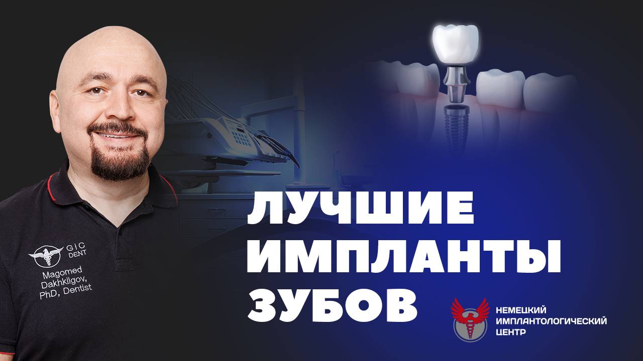 Какие зубные импланты лучше? Когда качественная имплантация гарантирована имплантологическим центро