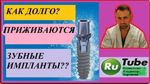 Как долго приживаются зубные  импланты? #имплантзуба #нетзуба #стоматолог