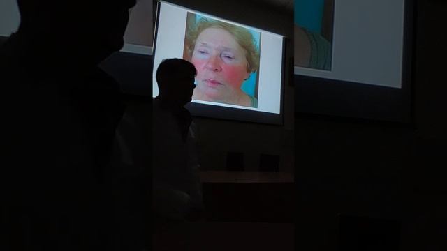 Нейроэндокринные опухоли: общие понятия, карциноидный синдром
