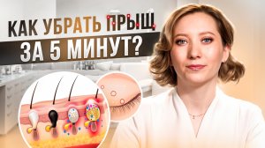 ПРЫЩИ | КАК УБРАТЬ ПРЫЩ? | ИЗБАВЬТЕСЬ ОТ ЧЁРНЫХ ТОЧЕК | NEW WAY CLINIC