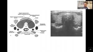 Инструментальные (визуализирующие) методы диагностики в эндокринологии: общие представления