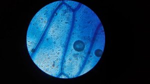 КАК УВИДЕТЬ ЯДРО КЛЕТКИ В МИКРОСКОП