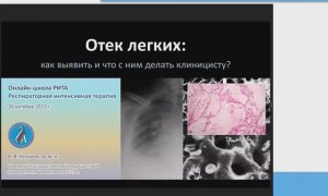 Гипергидратация и отек легких