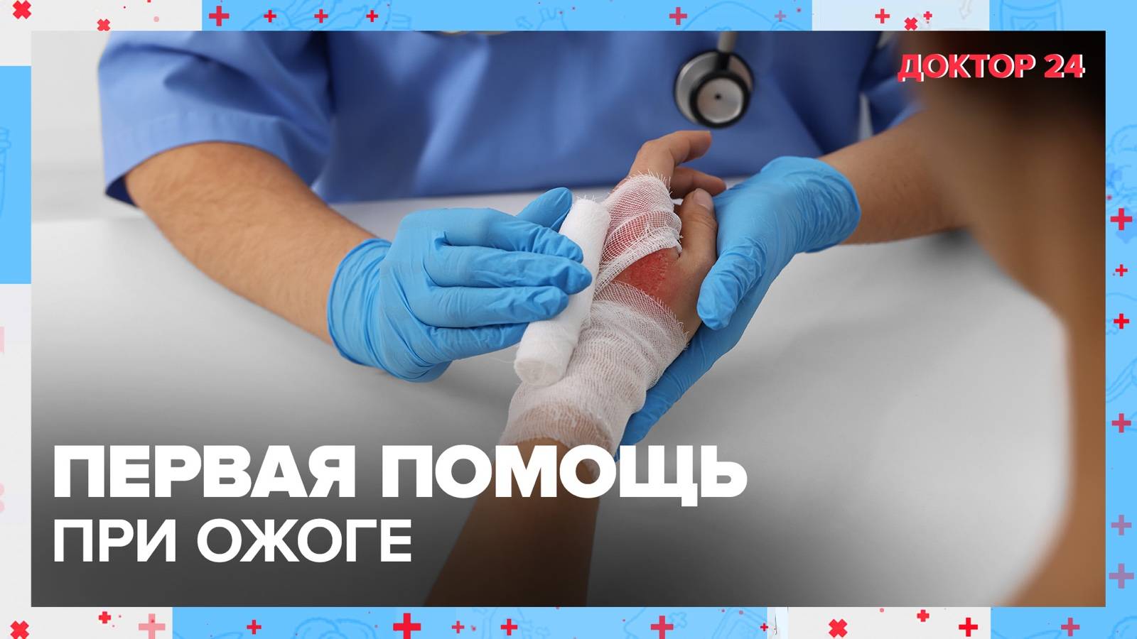 Первая помощь при ОЖОГЕ | Доктор 24