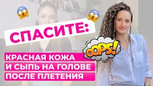 Почему после плетения кожа покраснела, появилась сыпь и что с этим делать?