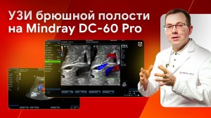 УЗИ органов брюшной полости (ОБП) на Mindray DC-60 Pro