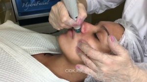 Как готовилась к свадьбе Мария Мельникова в ЦИДК. Этап 1. Очищение кожи HydraFacial