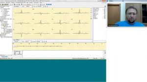 Основы ЭКГ (вебинар), ч.1