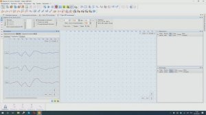 Зрительные вызванные потенциалы на вспышку (ЗВПВ)