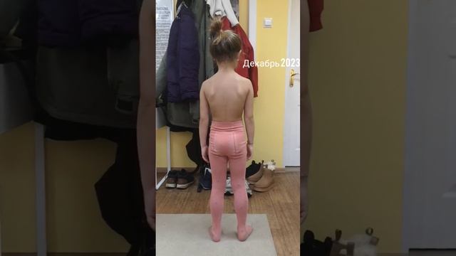 Убрали искривление позвоночника и перекос таза