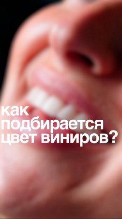 Как подбирается цвет виниров ❓