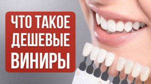 Дешевые Виниры или Качественные: Что лучше для Ваших Зубов?