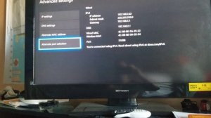 How to fix teredo ip issue on Xbox One and Series X 100% (Still working in 2024)