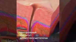 ОБРАЗОВАНИЕ ВОСПАЛИТЕЛЬНЫХ ЭЛЕМЕНТОВ АКНЕ