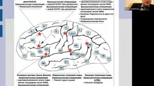 Транскраниальная ритмическая магнитная стимуляция в нейрореабилитации