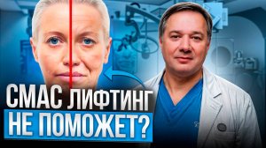 Что такое SMAS лифтинг и как он работает [Это не круговая подтяжка лица?]