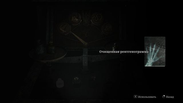 Silent Hill 2 Remake#12