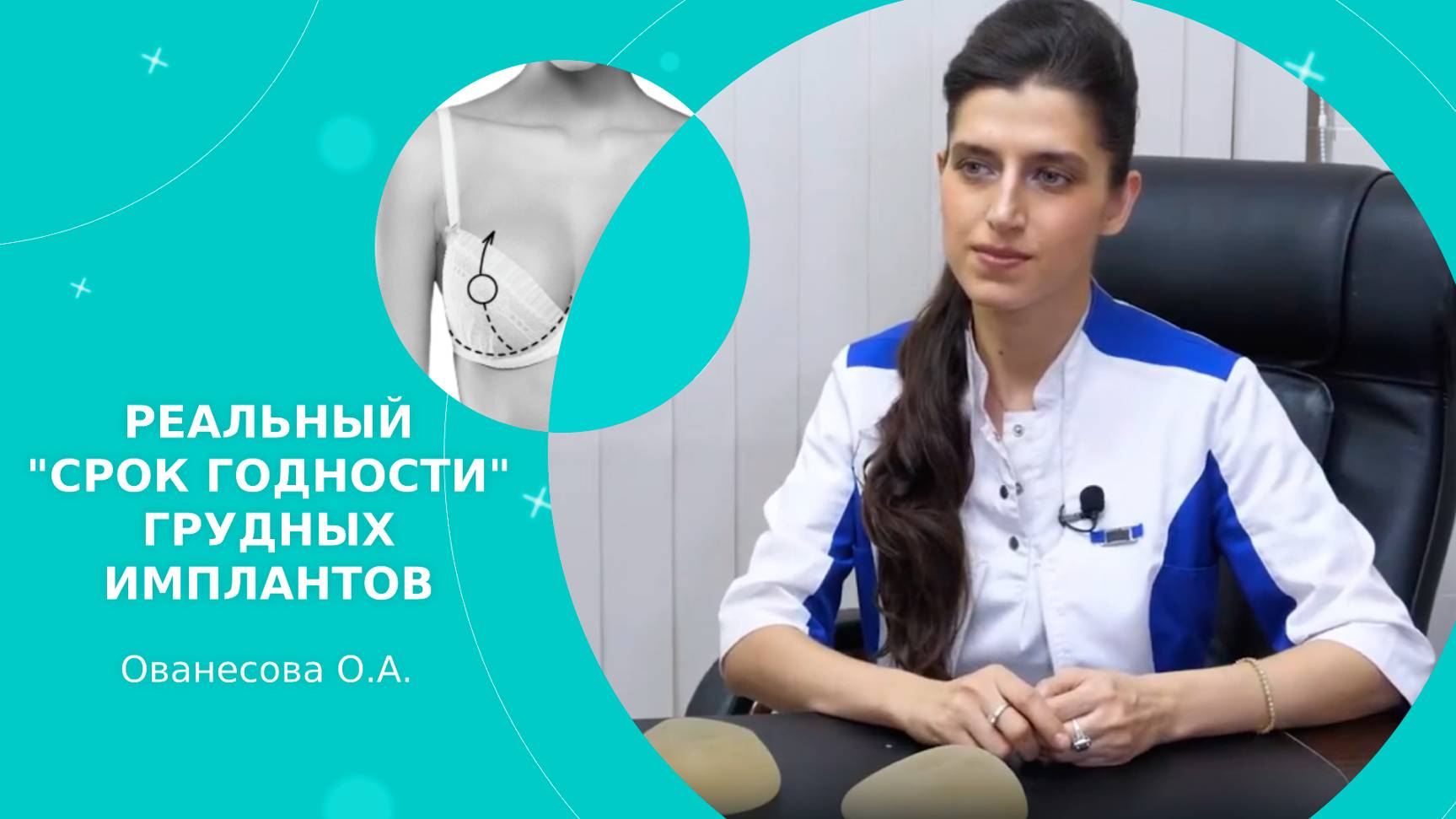 РЕАЛЬНЫЙ «СРОК ГОДНОСТИ» ГРУДНЫХ ИМПЛАНТОВ! Отвечает хирург Ованесова О.А