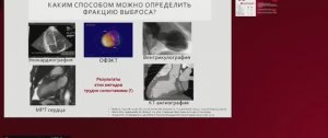 Оценка фракции выброса ЛЖ у пациентов с ХСН в свете современных рекомендаций