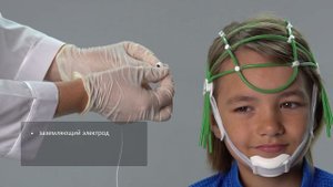 Всё о корпусированных чашечковых электродах для ЭЭГ-обследований за 1 минуту