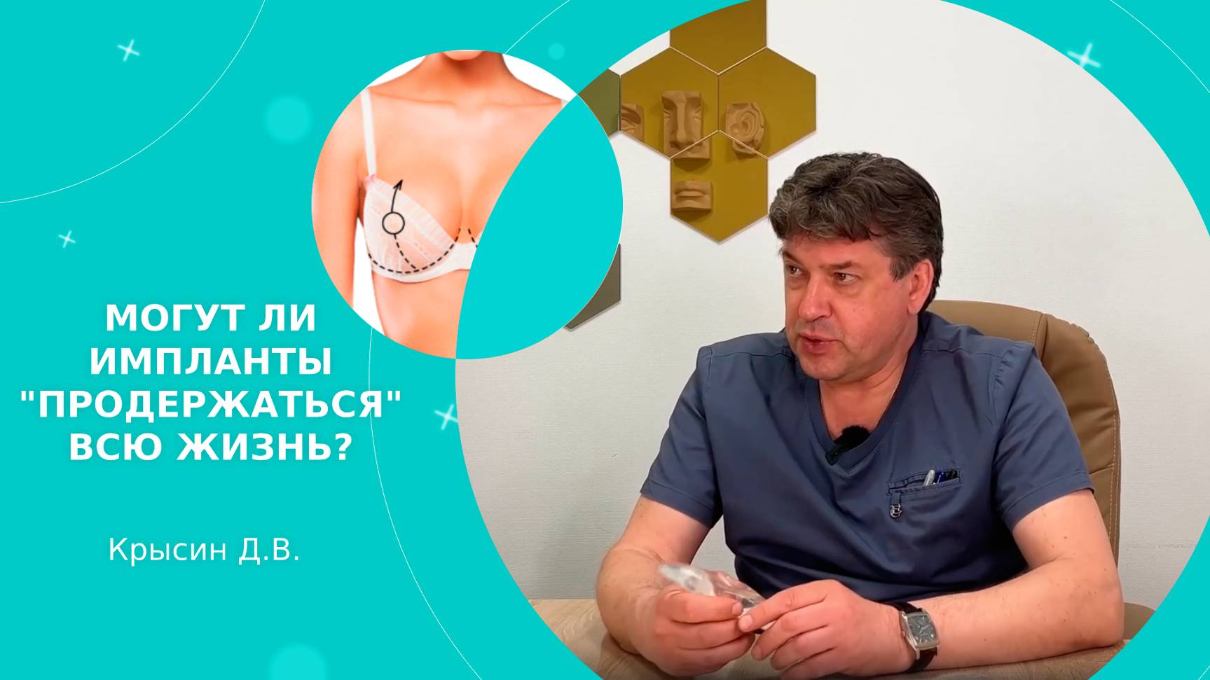 МОГУТ ЛИ ИМПЛАНТЫ «ПРОДЕРЖАТЬСЯ» ВСЮ ЖИЗНЬ? Отвечает хирург Крысин Д.В.