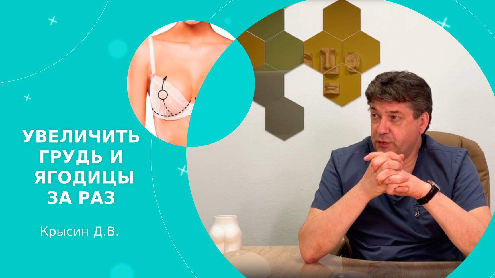 УВЕЛИЧИТЬ ГРУДЬ И ЯГОДИЦЫ ЗА РАЗ! Рассказывает хирург Крысин Д.В.