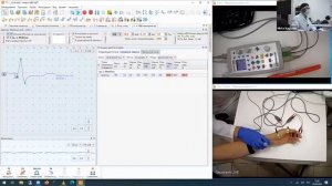 Сенсорное проведение (ПД нерва) | Вебинар «ЭМГ для начинающих» Часть 6