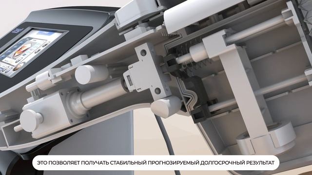 UCOS HIFU: уникальная система стабилизации.