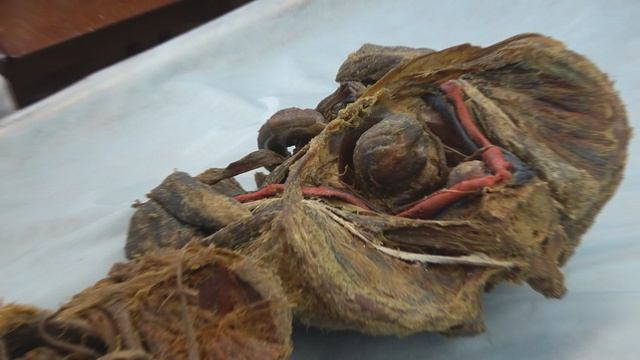 Топографическая анатомия нижней конечности. Часть 3